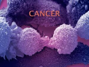 CANCER