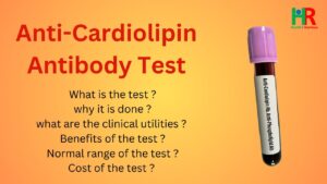 Anti cardiolipin