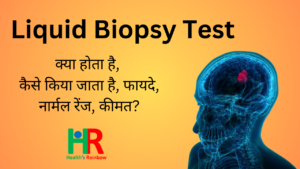 Liquid Biopsy Test